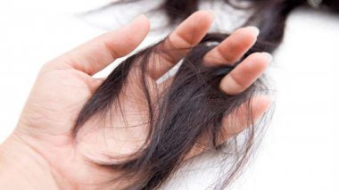 Rụng tóc nhiều ở nam và nữ là biểu hiện của bệnh gì. Nguyên nhân...